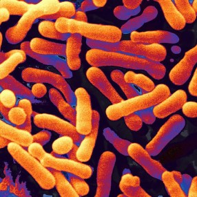 4-bifidobacterium-animalis-scimat